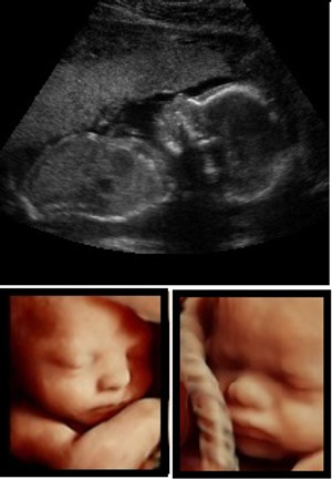 "LET'S WATCH YOUR BABY GROW!" up to 3 visits (50% OFF Promo) - Includes FREE HeartBeat Animal, Free Maternity Photography Session and more
