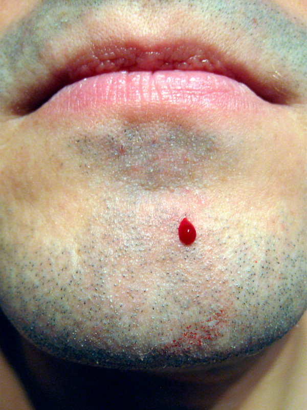Alum block – why use after shaving?