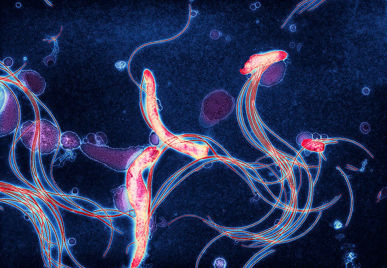 Patient Story: Lyme Disease