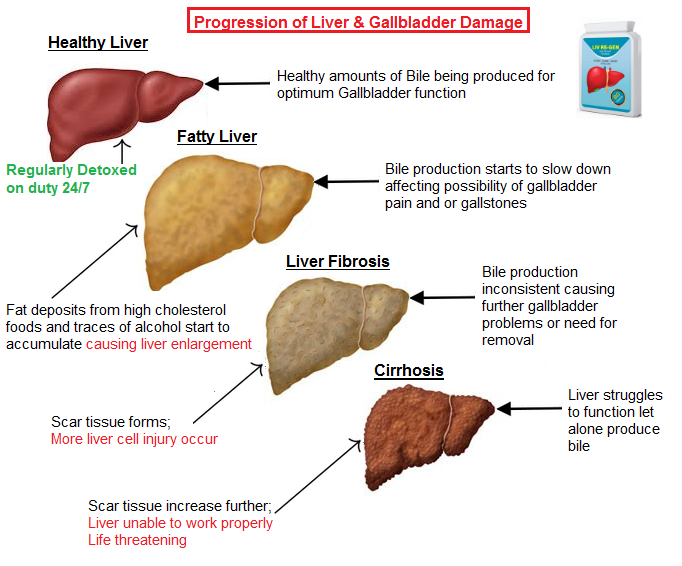 gallbladder-bile.png