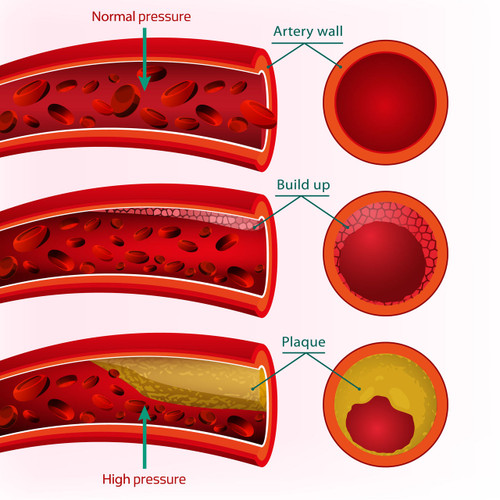 Screening for root causes of high blood pressure. Screening for root causes of high blood pressure.