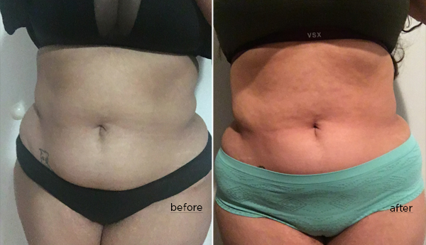 Waist Training Before & Afters: Customer Stories & Photos