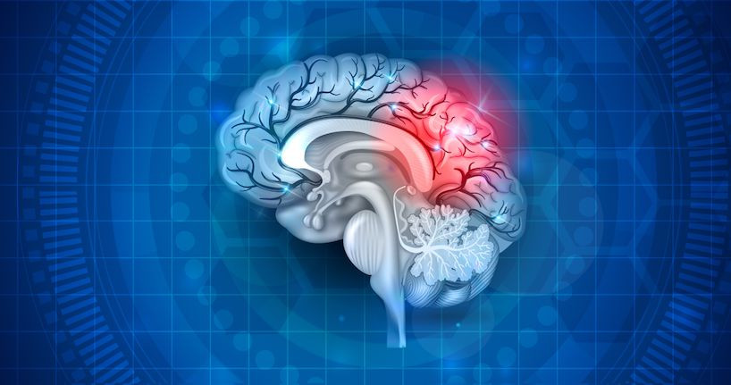 12 Likely Symptoms of Post-Concussion Syndrome 12 Likely Symptoms of Post-Concussion Syndrome