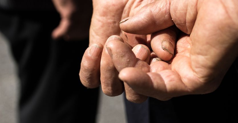 Lasting impact of elderly migraine on patients