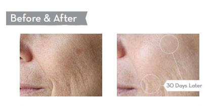 c-serum-before-and-after.jpg
