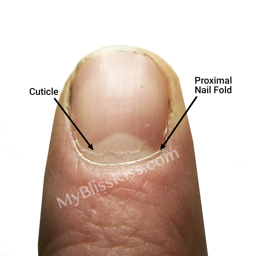 What Is The Cuticle Of The Nail