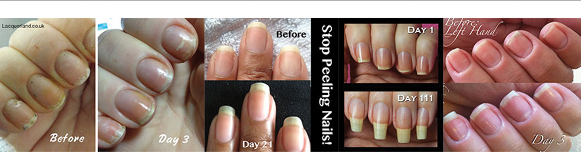 gnc-nails-before-and-after.png
