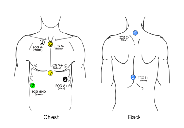 Analog Heart Rate Monitor Sensor (ECG) - Pixel Electric Engineering ...